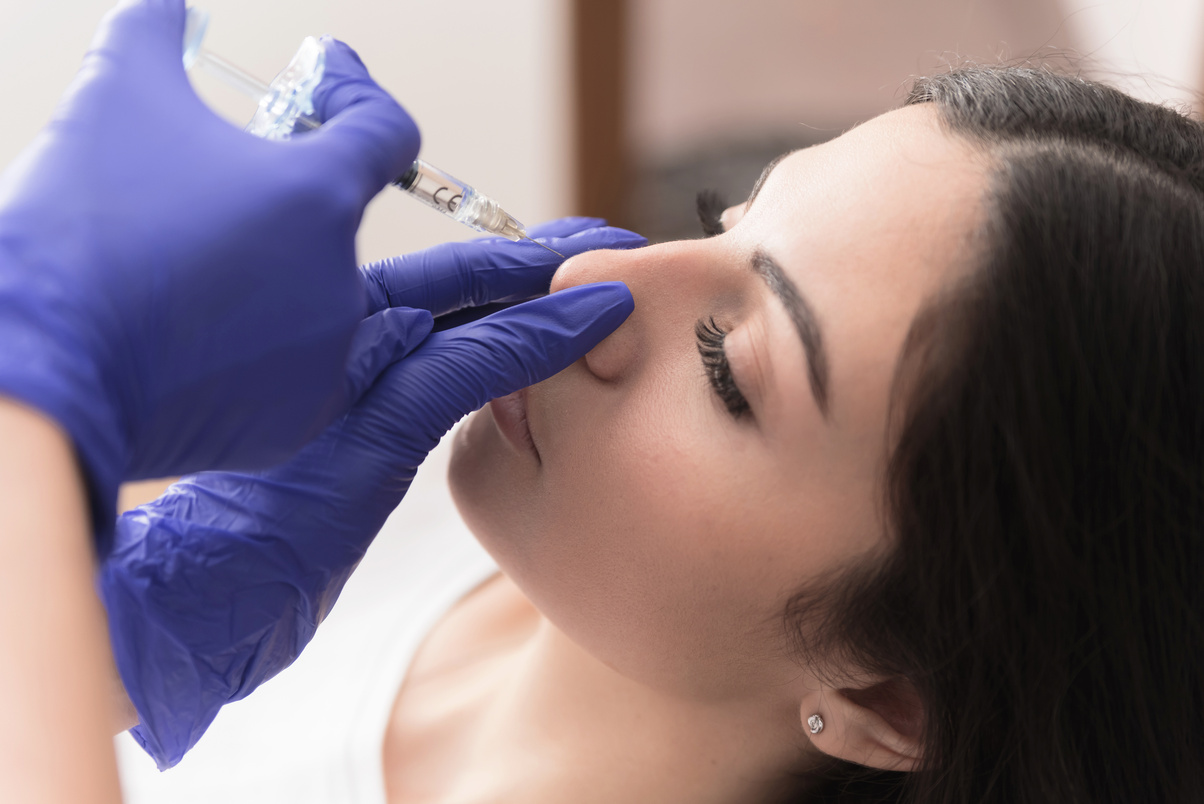 Non invasive rhinoplasty on female patient
