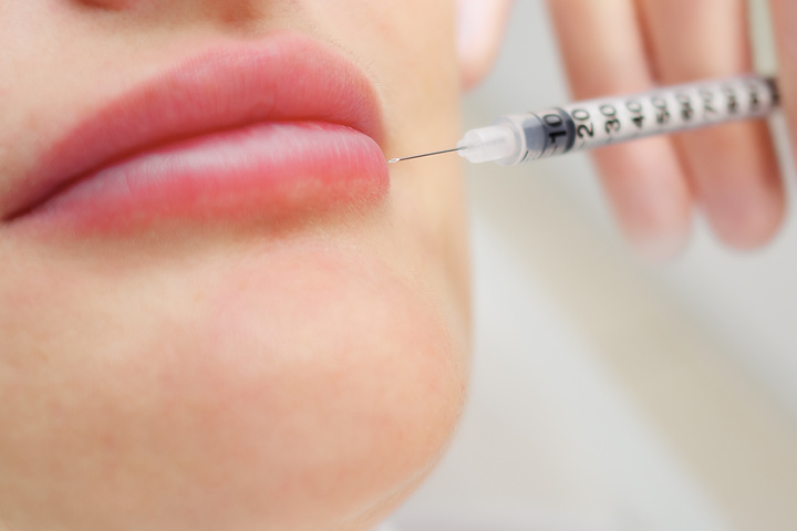 plastic surgeon injects filler to increase lips volume