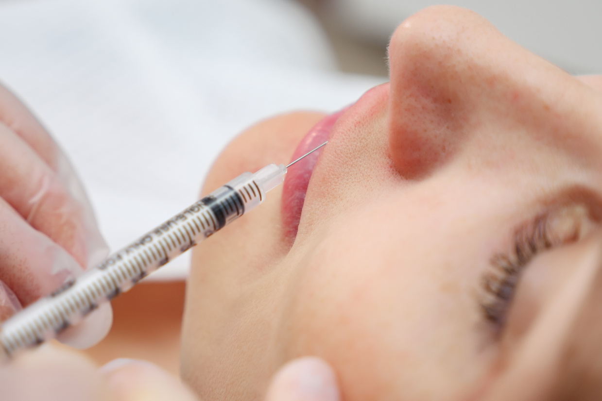 plastic surgeon injects filler to increase lips volume