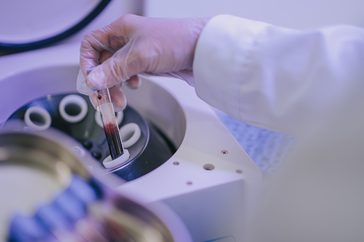 Cosmetologist does prp therapy asian chinese nurse working on platelet-rich-plasma therapy using centrifuge machine holding blood collection tube